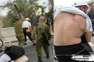 Fue golpeado por un coronel del Ejército israel&iacute