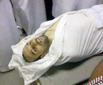 Dos mártires y decenas de heridos en Arabia Saudita