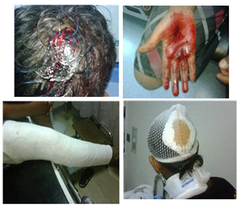 Los ni&ntildeos del Bahréin, las victimas m&aacutes débiles