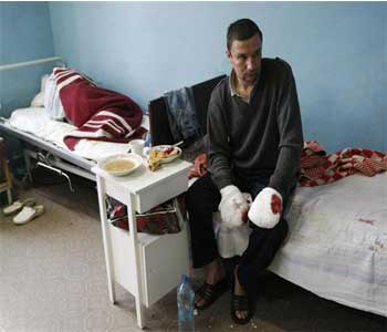 A 17 grados bajo cero
