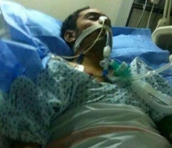 Después de una semana en Coma 