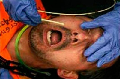 Alimentación forzosa en Guantánamo