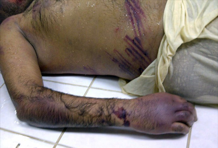 Tribunal bahreiní absuelve a 2 policías acusados de torturar a médicos