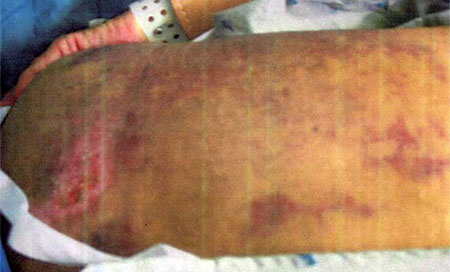 Publican 198 fotografías de prisioneros torturados en Irak y Afganistán