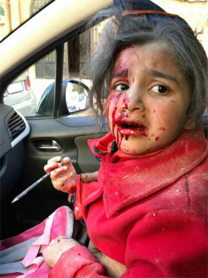 Mueren 8 niños sirios en un ataque terrorista con proyectiles