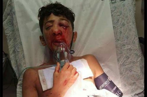 La ocupación israelí “ciega la luz” de un ojo al palestino Nur