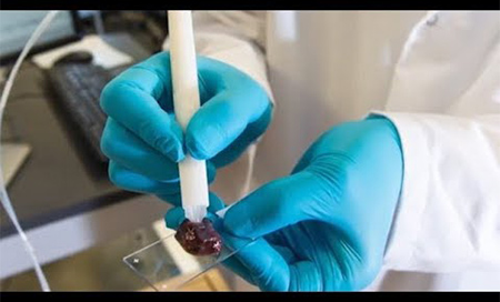 Diagnosticar el cáncer en tan sólo 10 segundos 