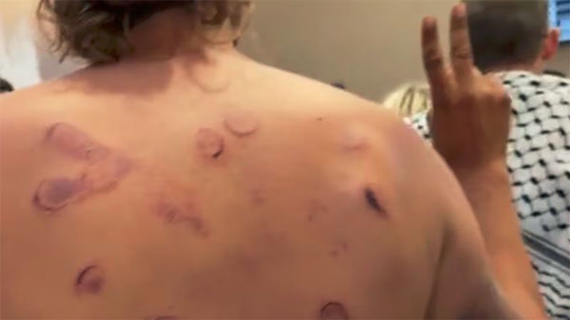 Los activistas brasile&ntilde;os de la Flotilla denunciaron golpizas y casos de violencia sexual